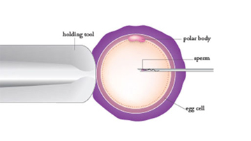 Shai Raksha Fertility Centre | Fertility Centre in Chennai, Medavakkam