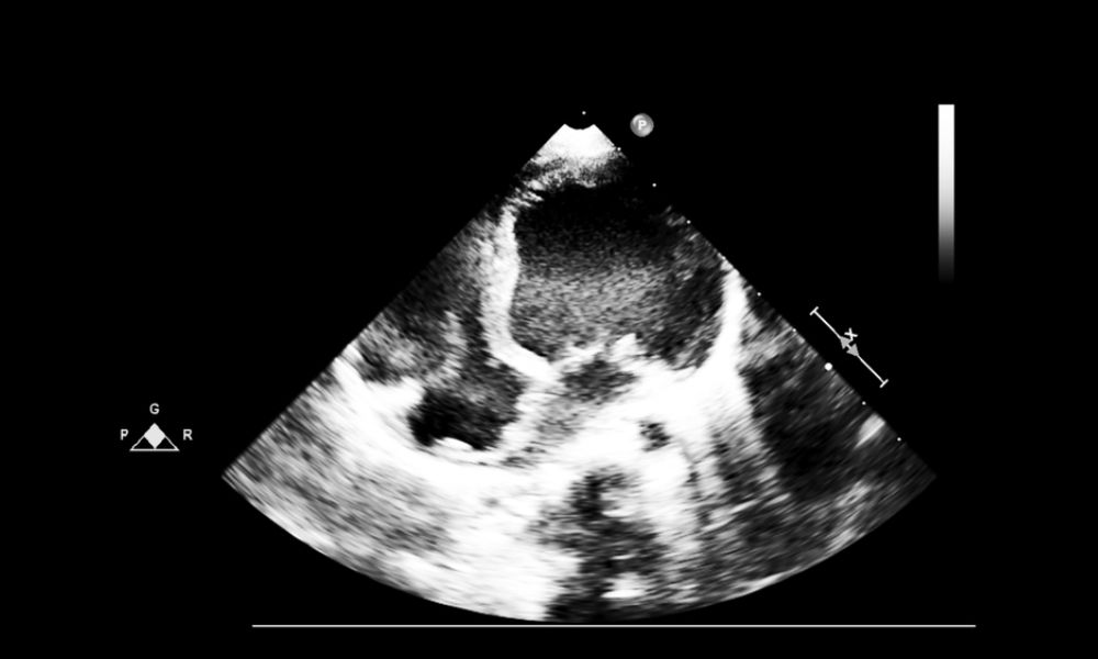 Shairaksha | Ovulation Induction