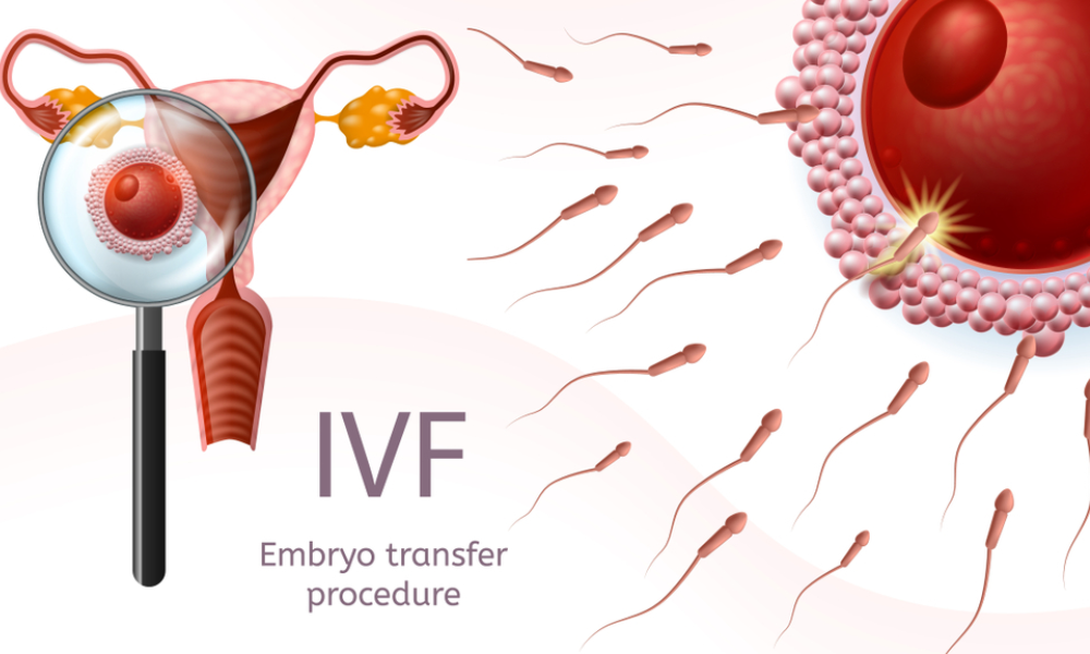 Shairaksha | ICSI – Intracytoplasmic Sperm Injection.