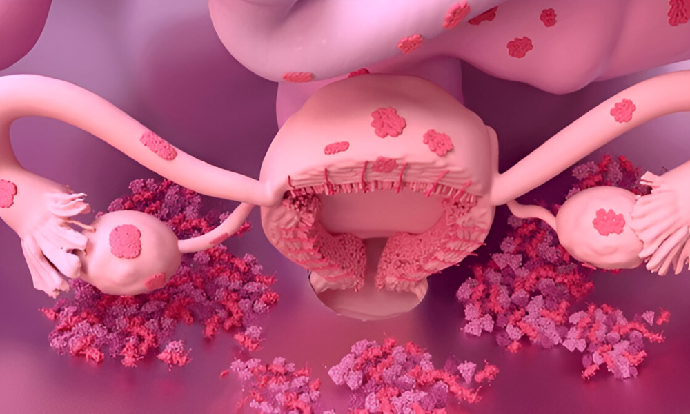 Shairaksha | Diagnostic Laparoscopy