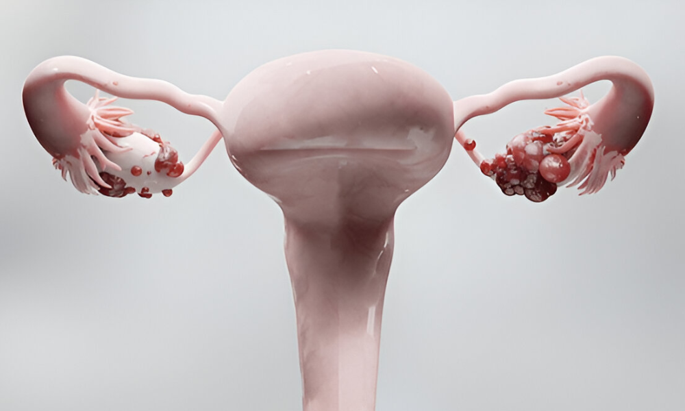 Shairaksha | Diagnostic Laparoscopy