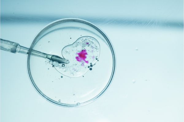 Shairaksha | IVF – In Vitro Fertilization