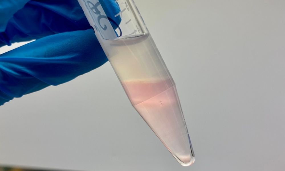 Shairaksha | IUI –Intrauterine Insemination.