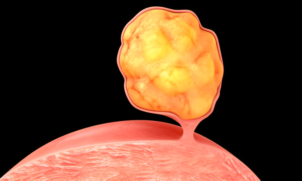 Shairaksha | Hysteroscopic Procedures