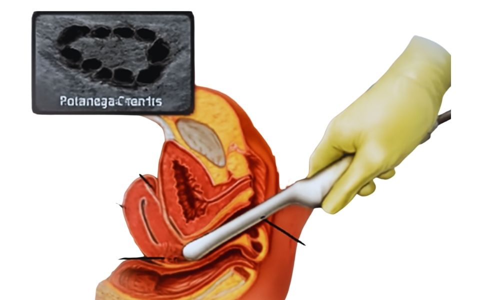 Shairaksha | Follicular Study